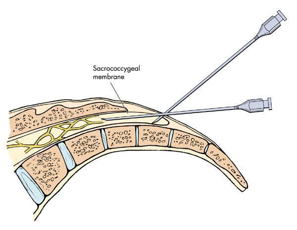 为吸引更多企业，GoogleCloud与IBM达成战略合作|beat365(图4)